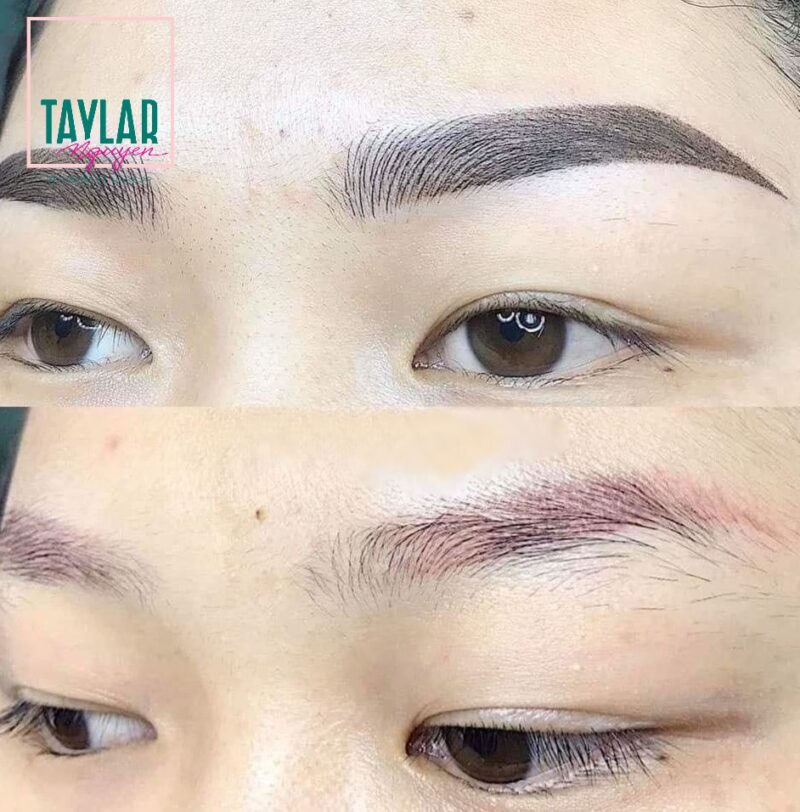 Chân mày bị đứt đoạn, mất sợi