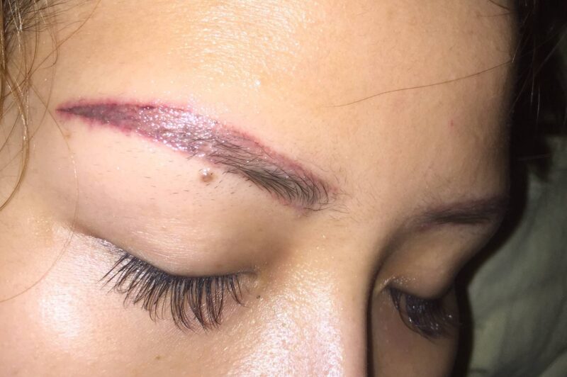 Hậu quả điêu khắc lông mày hỏng là dáng mày không phù hợp