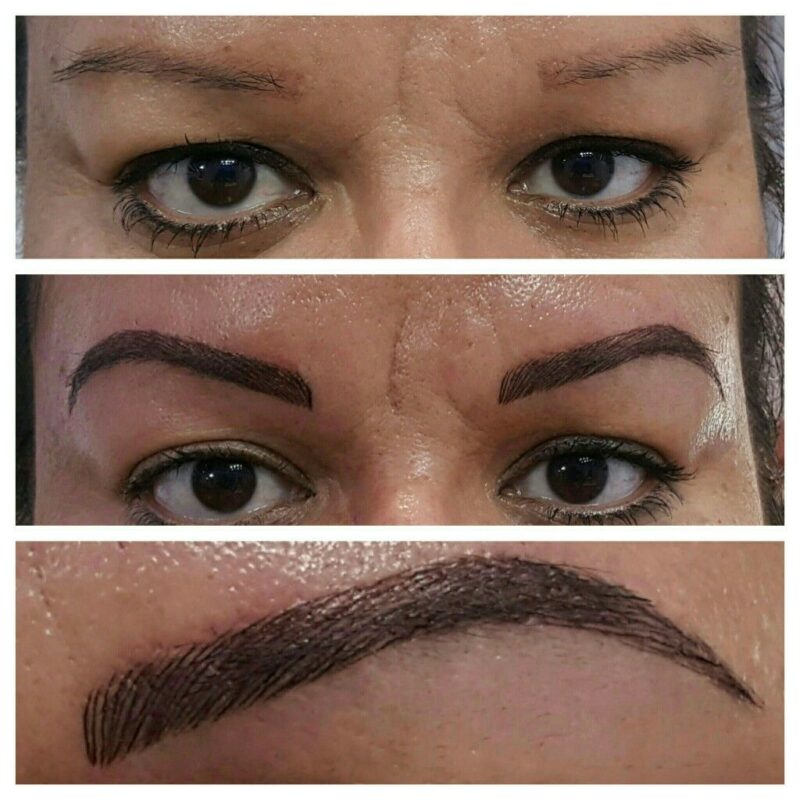 Không tuân thủ hướng dẫn sau thủ thuật