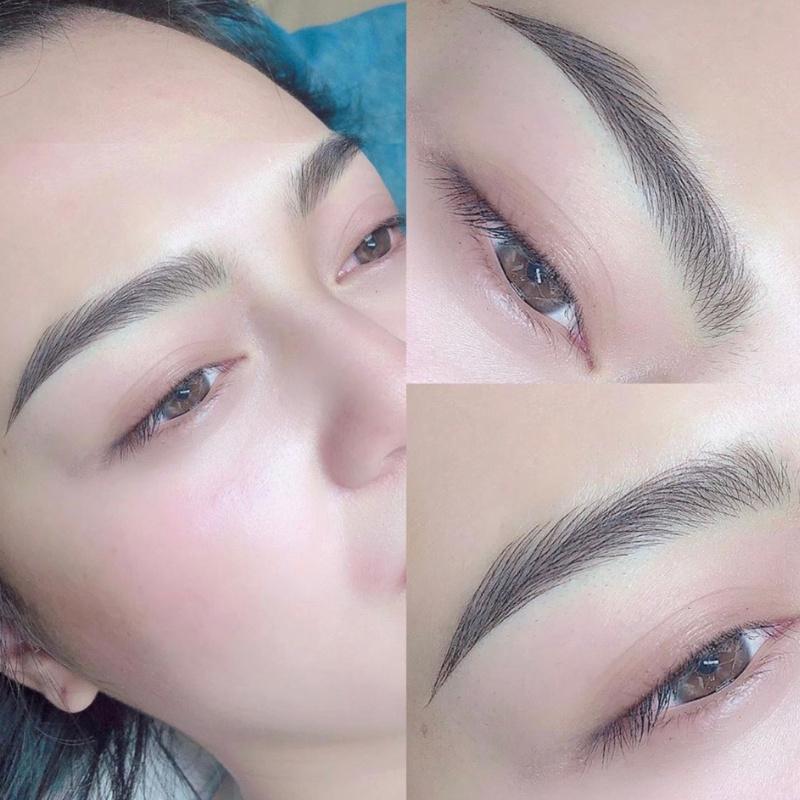 Vệ sinh và phòng tránh bệnh viêm nhiễm