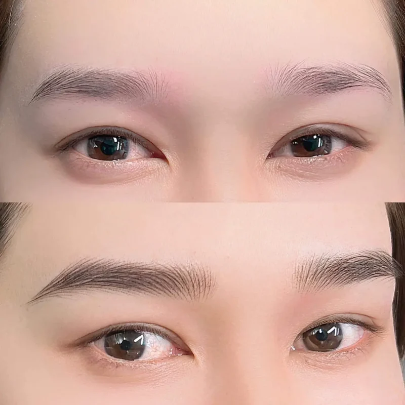 Điêu khắc lông mày có xóa được không?