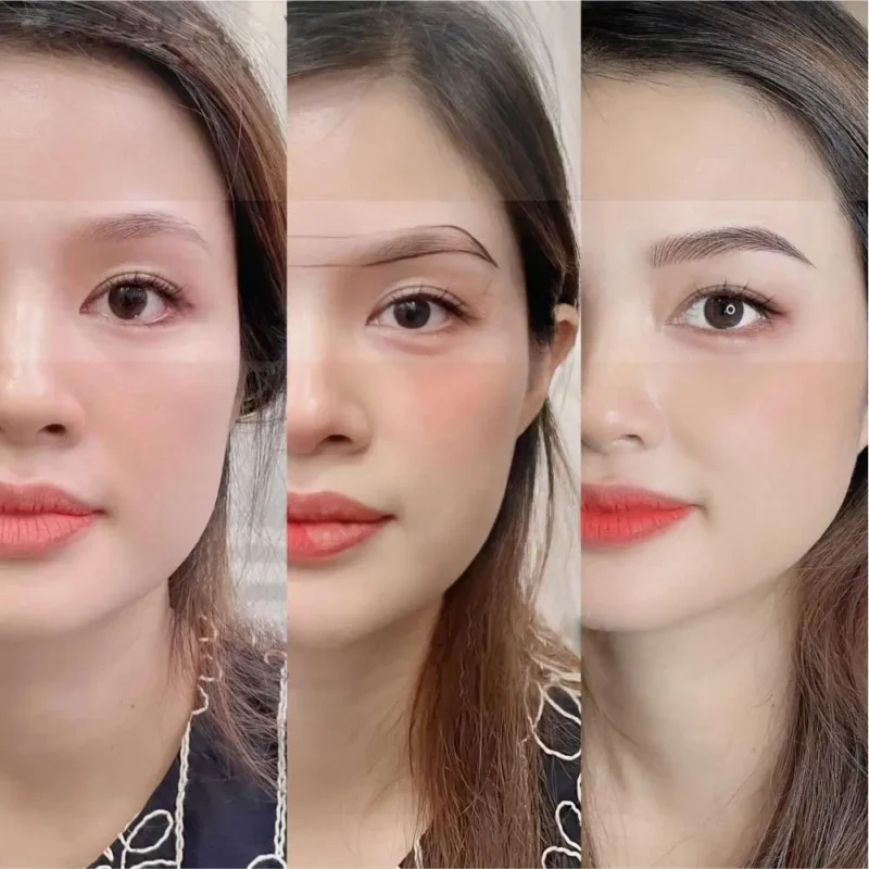 Điêu khắc lông mày có để lại sẹo không?