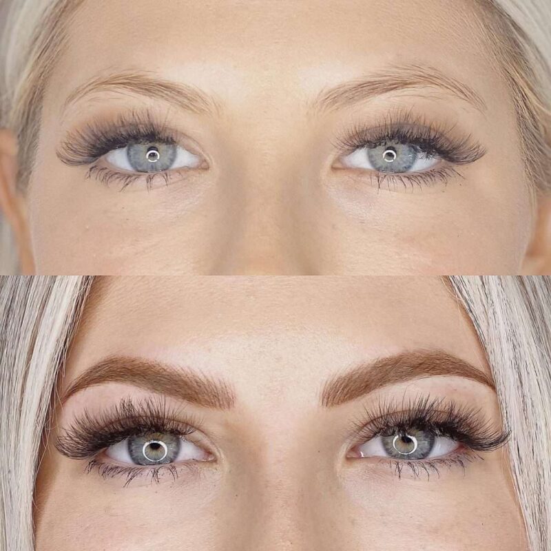 Kỹ thuật thực hiện