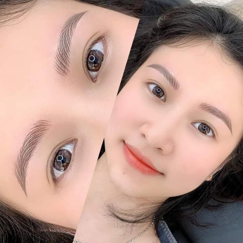 Sẹo chân mày có thể làm giảm hiệu quả của lần làm đẹp sau