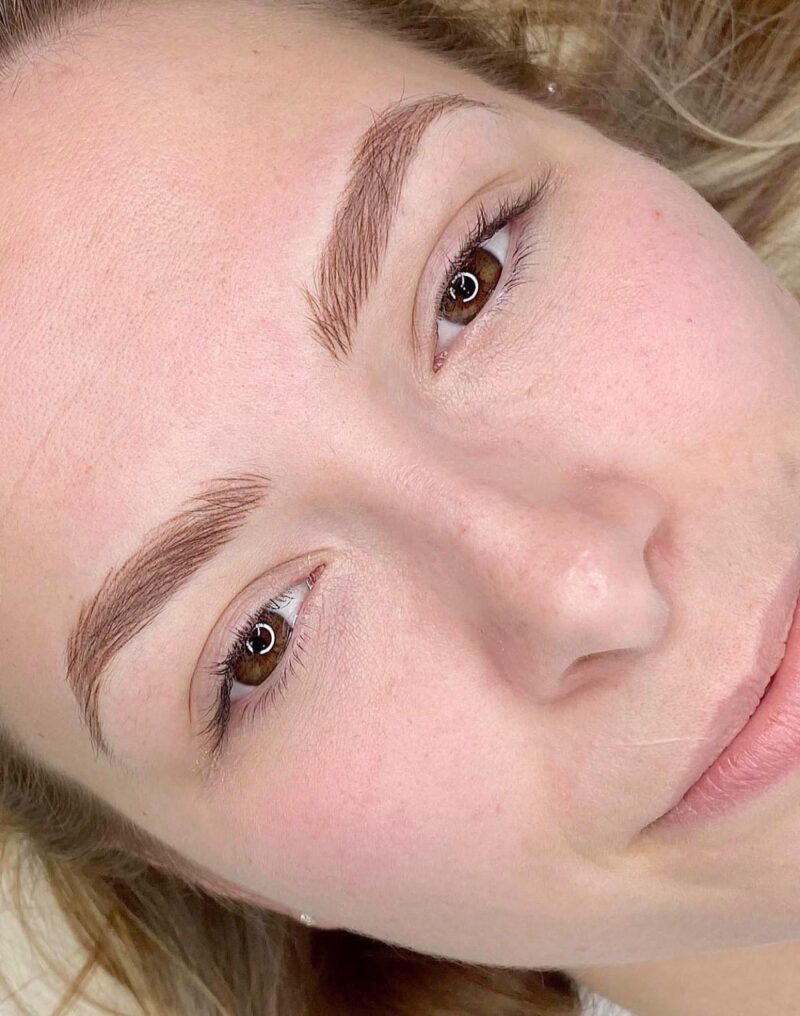 Yếu tố cơ địa