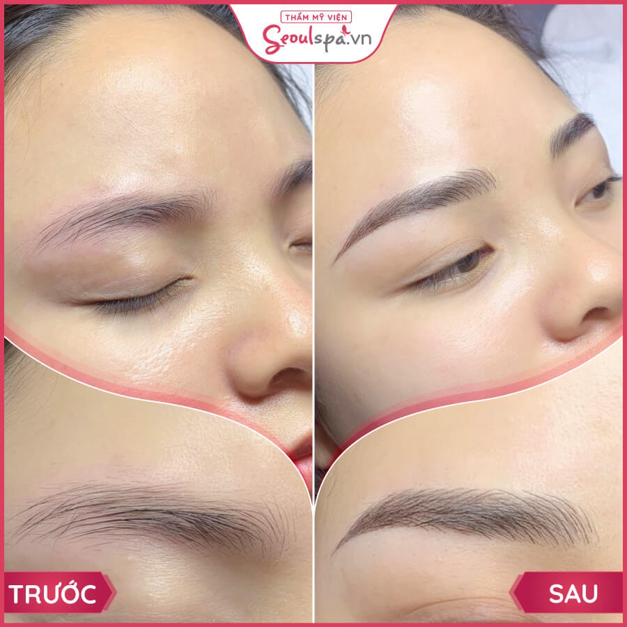 Thẩm mỹ viện Seoul Spa là gợi ý cho câu hỏi điêu khắc chân mày ở đâu đẹp