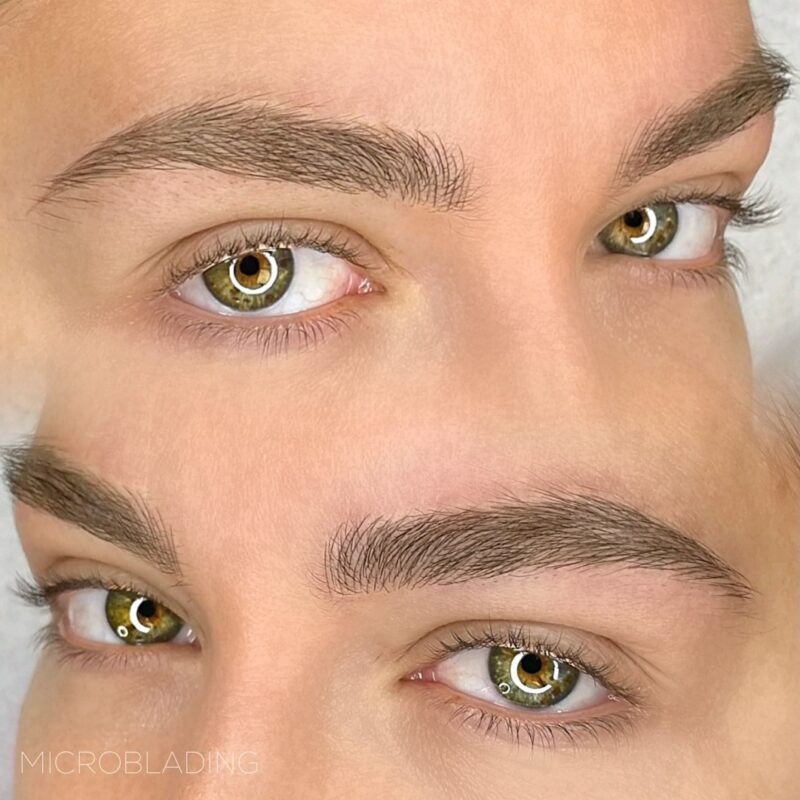 Thời gian kiêng ăn trứng là bao lâu?