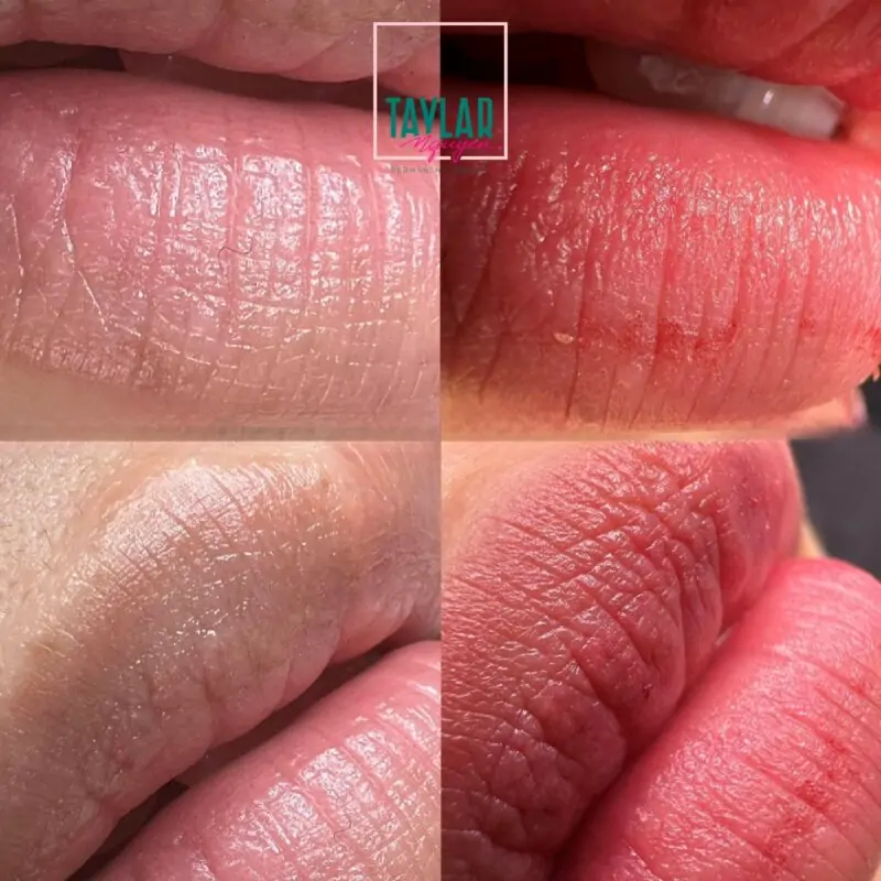 Phun Collagen môi giúp bờ môi căng mịn, tự nhiên