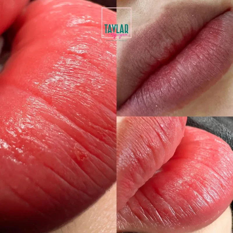 Kỹ thuật phun xăm môi Plasma khắc phục hoàn toàn tình trạng đôi môi thâm xỉnKỹ thuật phun xăm môi Plasma khắc phục hoàn toàn tình trạng đôi môi thâm xỉn