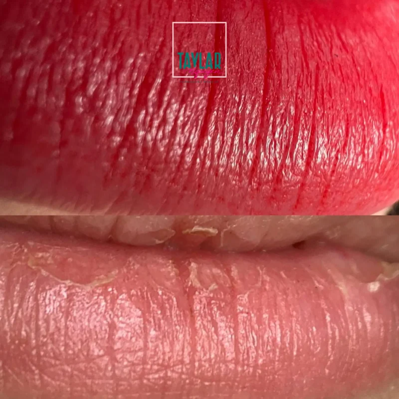 Đôi môi mềm mịn và căng mọng với kỹ thuật làm đẹp mới