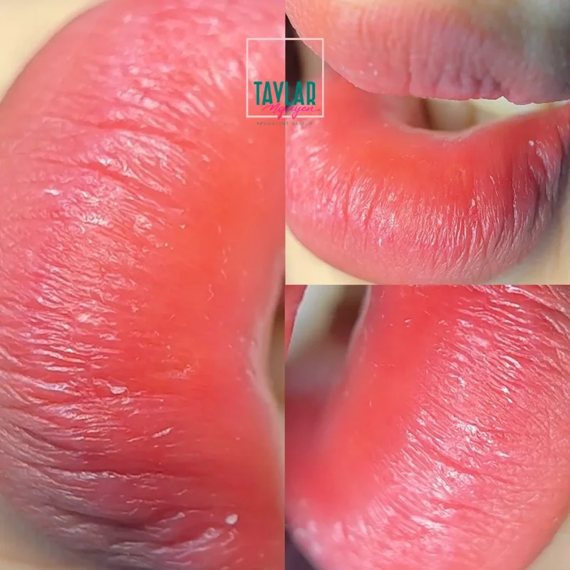 Loại bỏ hoàn toàn tình trạng môi thâm, xỉn màu