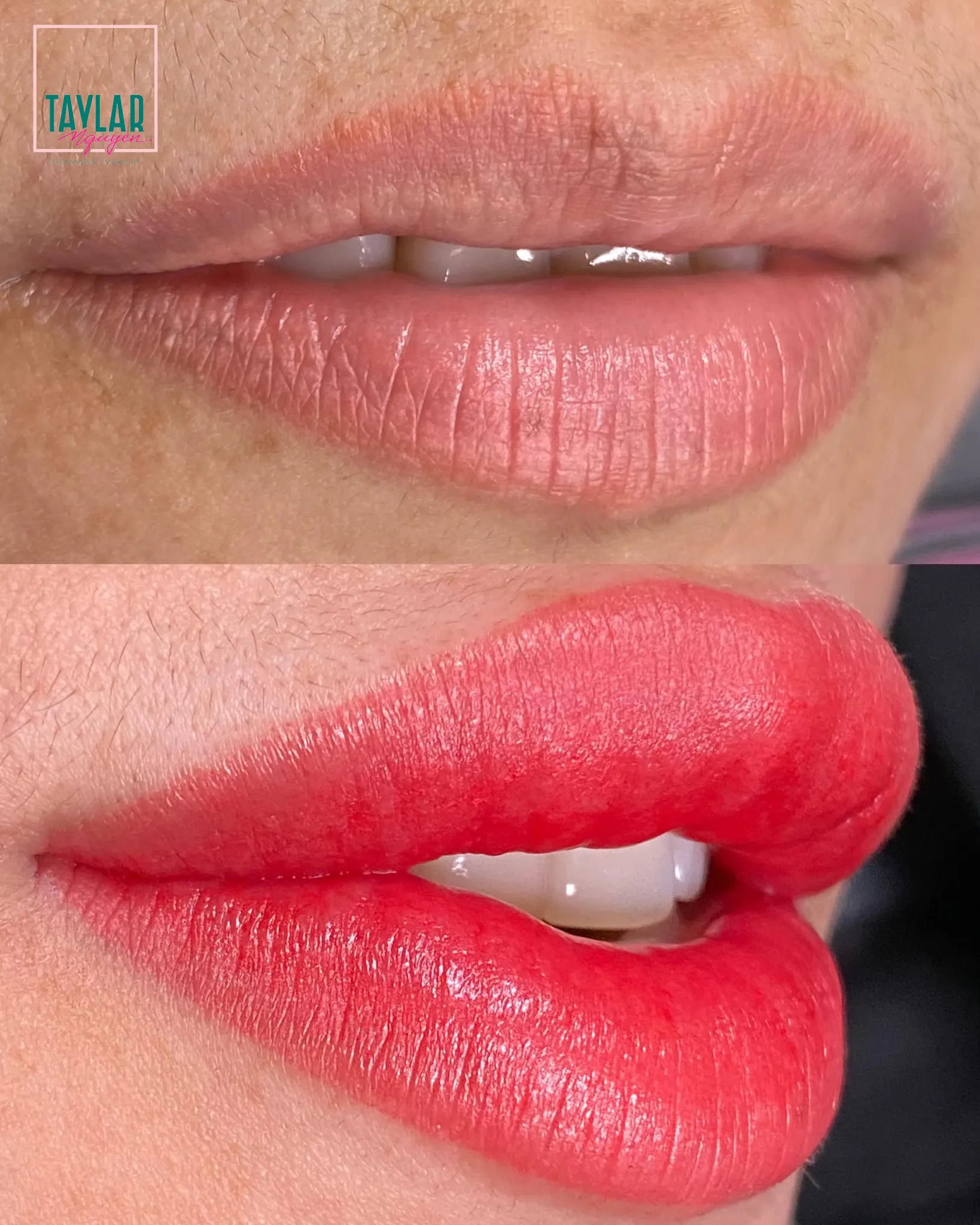 Hình ảnh trước và sau khi phun môi màu đỏ Ruby