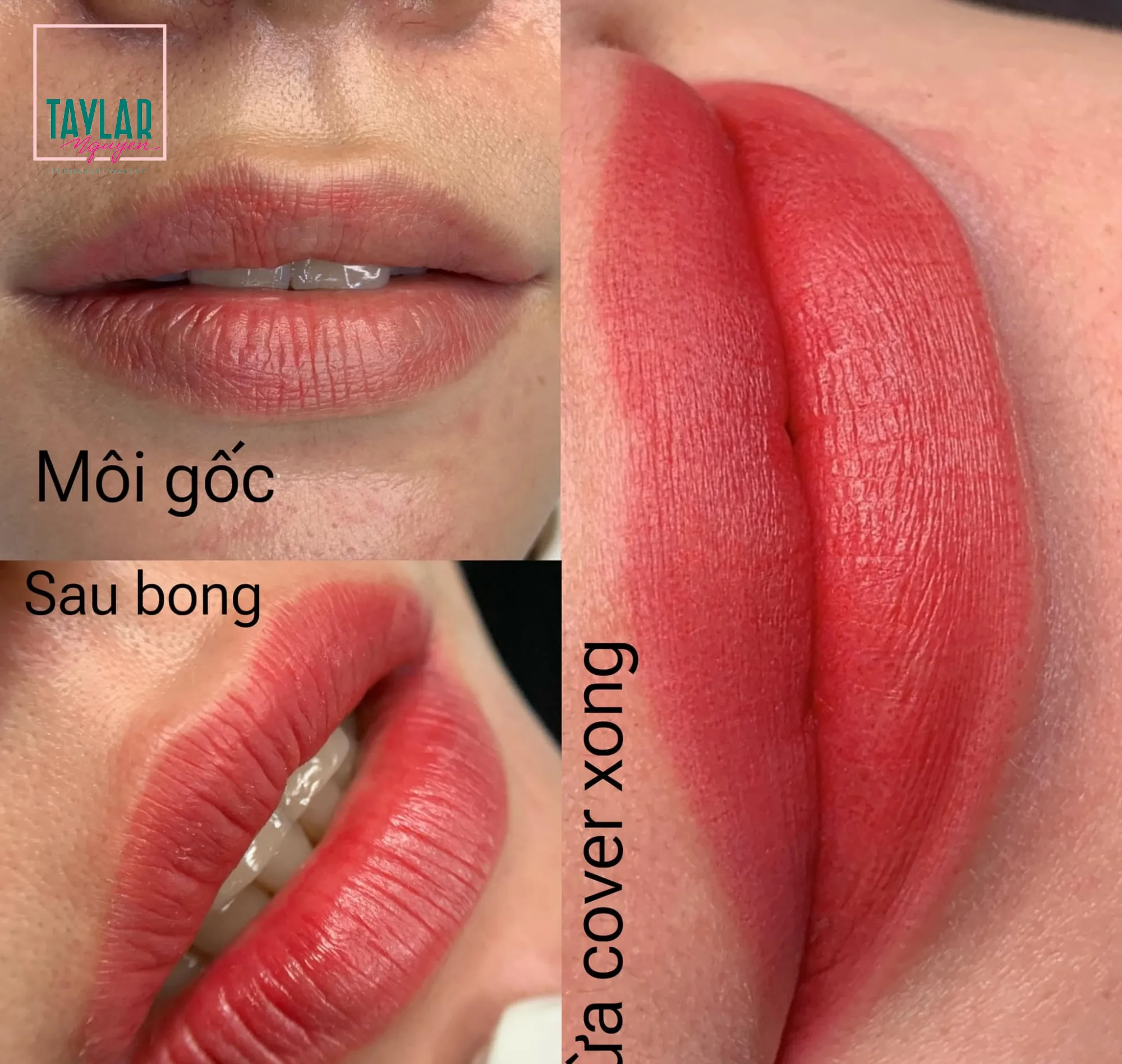 Đôi môi trước và sau khi phun 