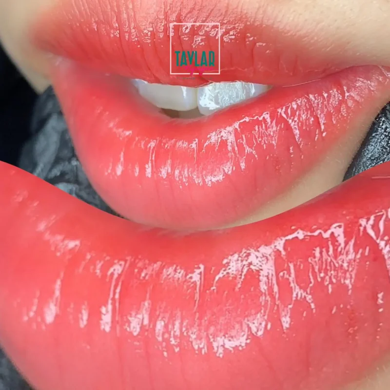 Phương pháp phun môi sinh học có độ an toàn cao