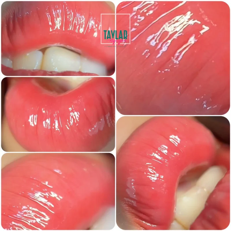 Cấy môi sinh học là gì