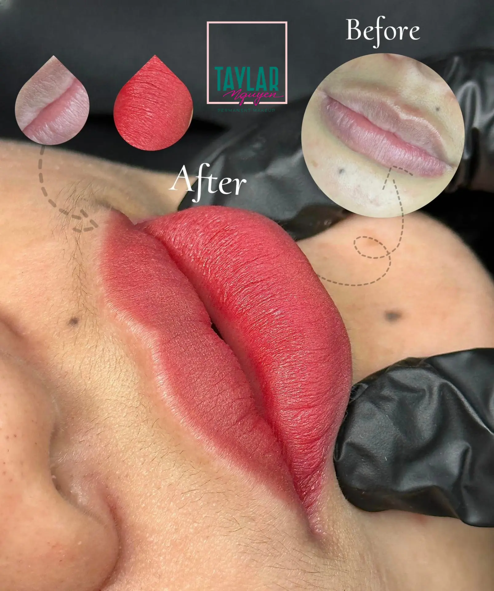 Phun môi công nghệ Softlips an toàn và hiệu quả