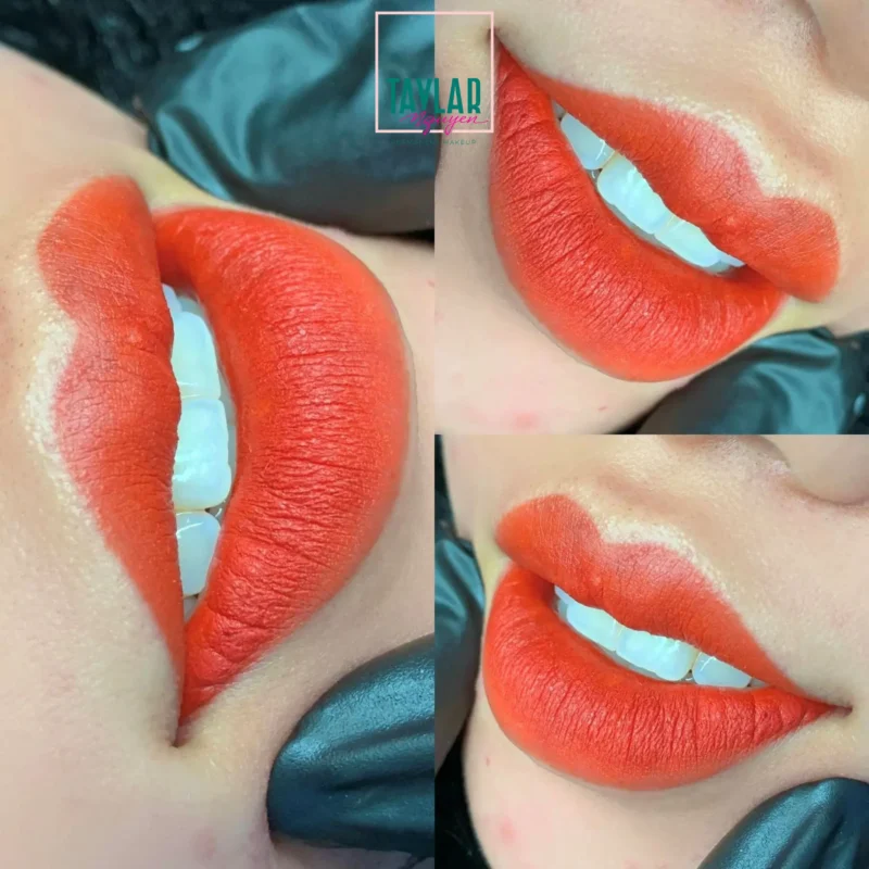 Không đau, không mất thời gian nghỉ dưỡng