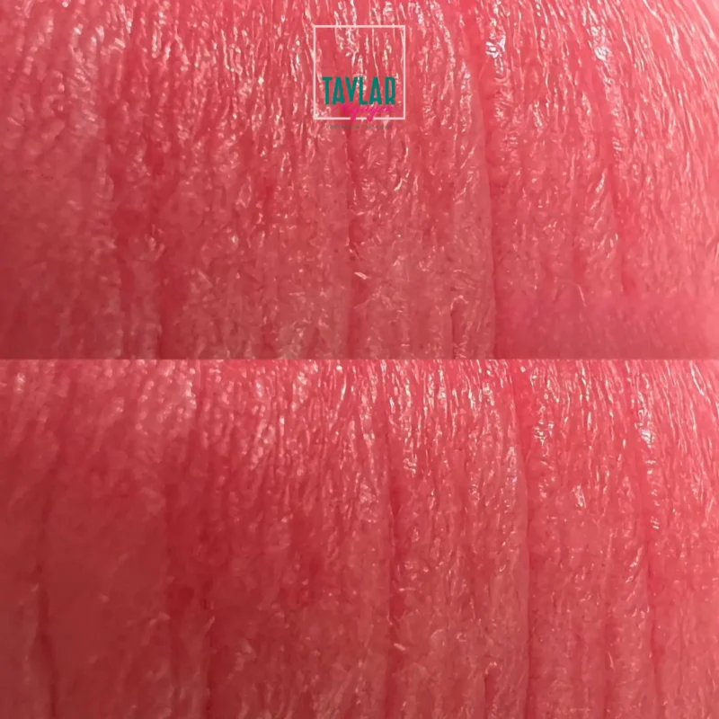 Bước 2: Vô trùng dụng cụ phun môi