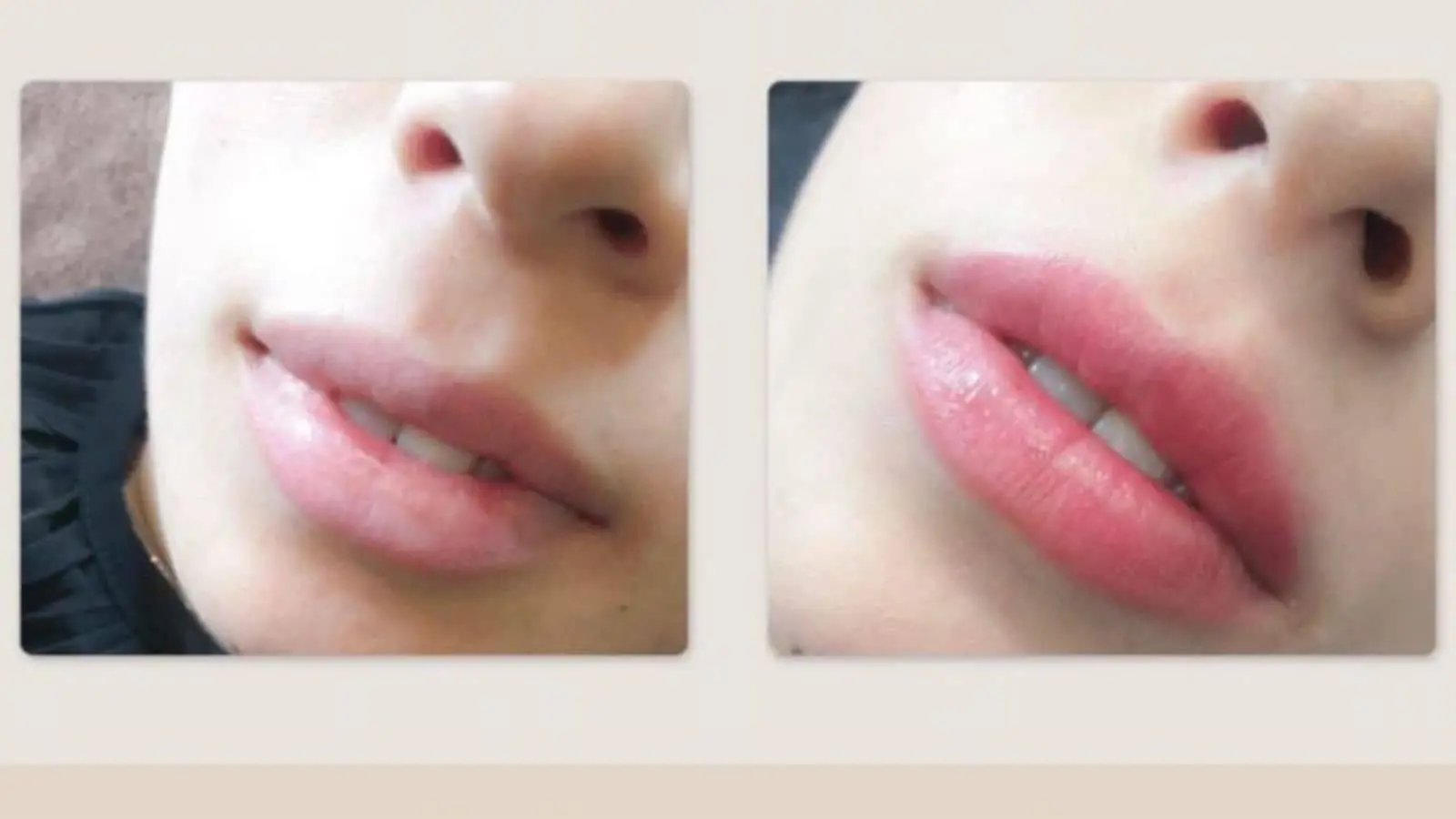 Thẩm Mỹ Viện Kangnam