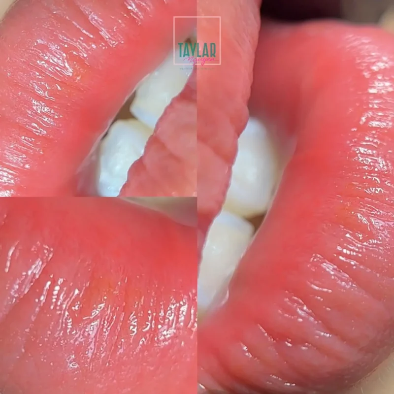 Tiêu chí đánh giá phun môi ở đâu uy tín