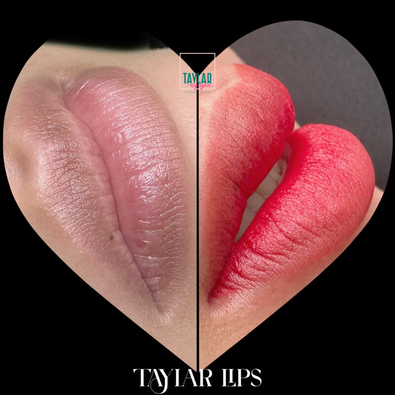 Hình ảnh trước và sau khi cấy môi sinh học