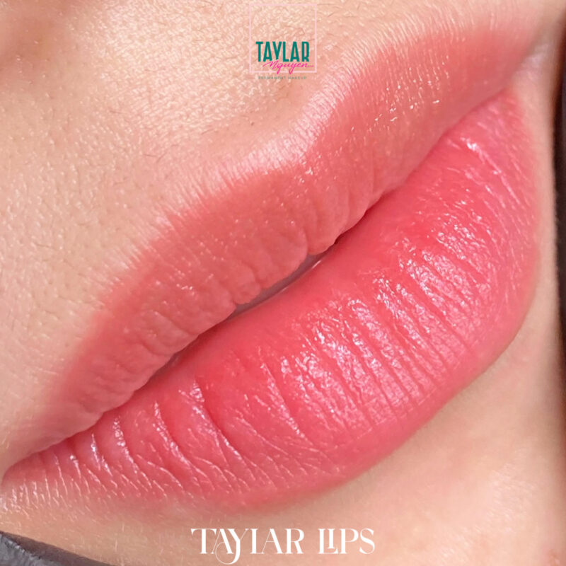 Cấy môi sinh học có tốt không? Có nên là không?