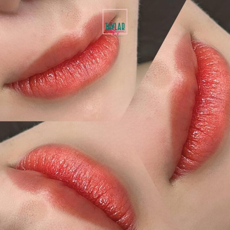 Cấy môi sinh học phù hợp với những ai?