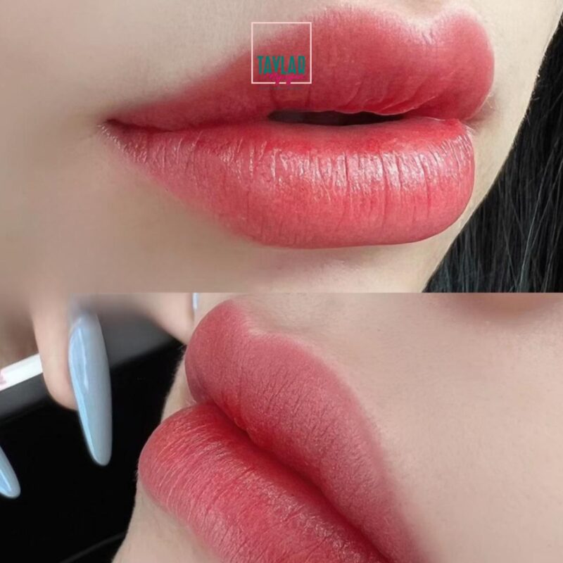 Chi phí và thời gian thực hiện cấy môi sinh học