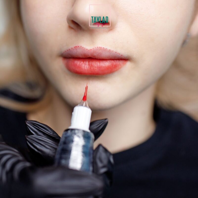 Tình trạng màu phun môi lên không đều có thể diễn ra sau khi phun xăm