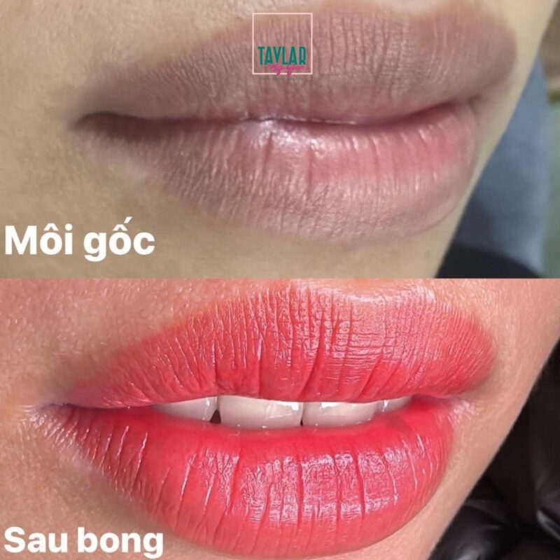 Những lưu ý trước khi phun xăm môi Collagen