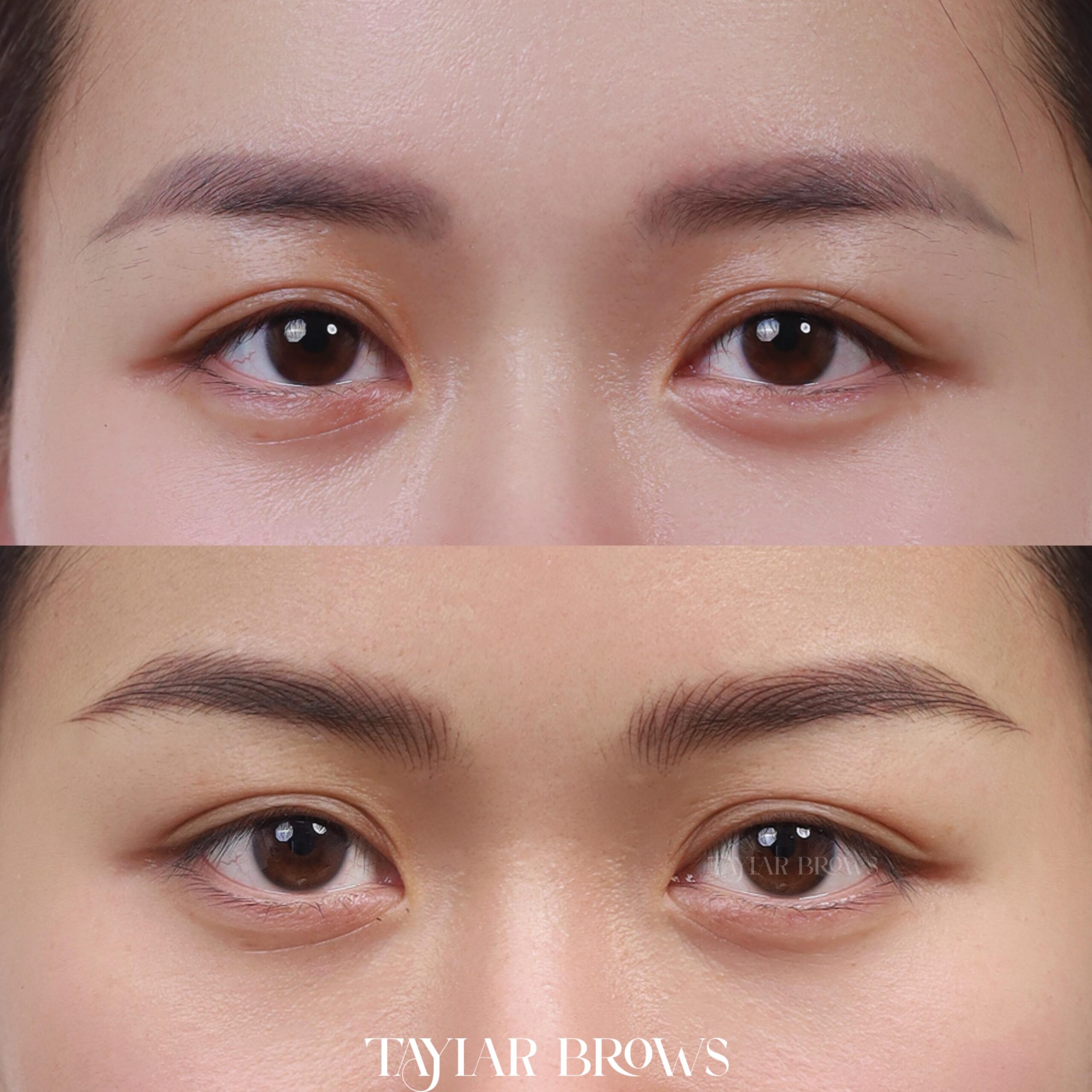 Giảm thiểu tổn thương da